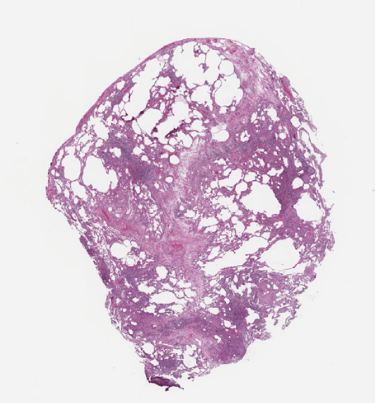 A lung tissue slide at magnification in the record's whole slide viewer.